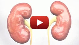 NSAIDs Renal Dysfunction Considerations